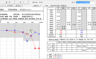 청력오디오그램 사진